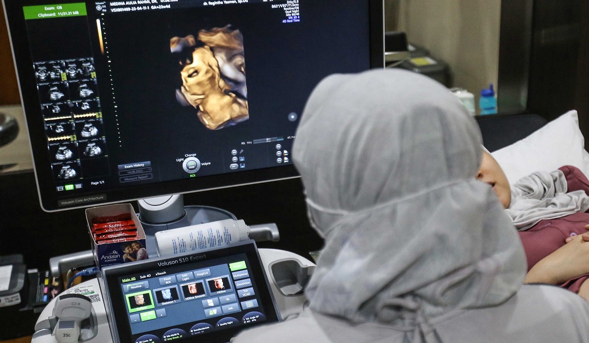 Ilustrasi: dokter spesialis kebidanan dan kandungan memeriksa janin ibu hamil dengan peralatan Ultrasonografi (USG) 