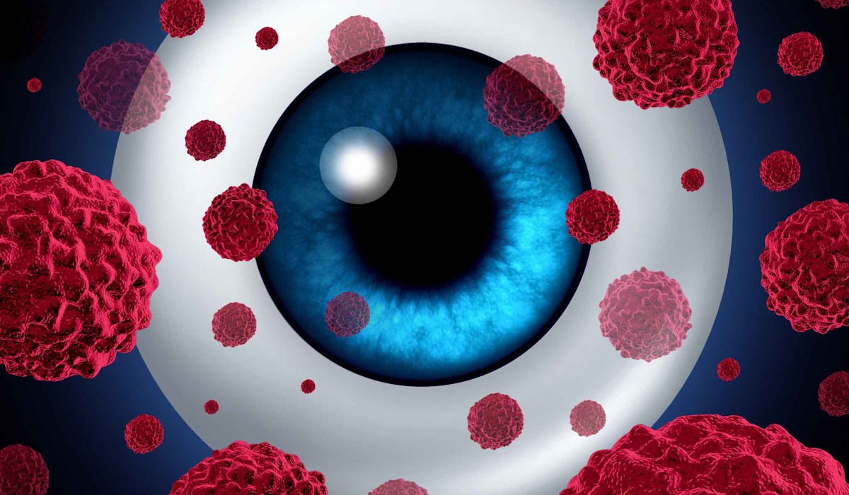 Pengembangan Vaksin mRNA dan Pemeriksaan Genomik untuk Pencegahan Kasus Kanker