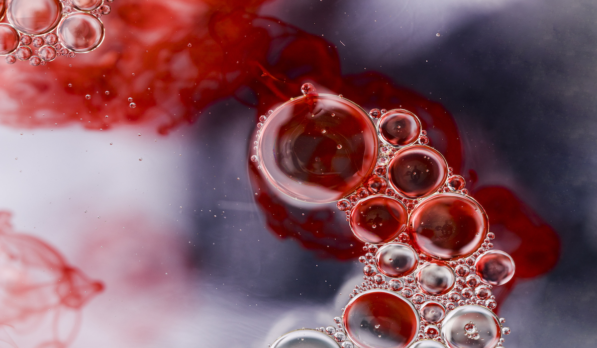 Penyakit Anemia Aplastic bisakah disembuhkan?