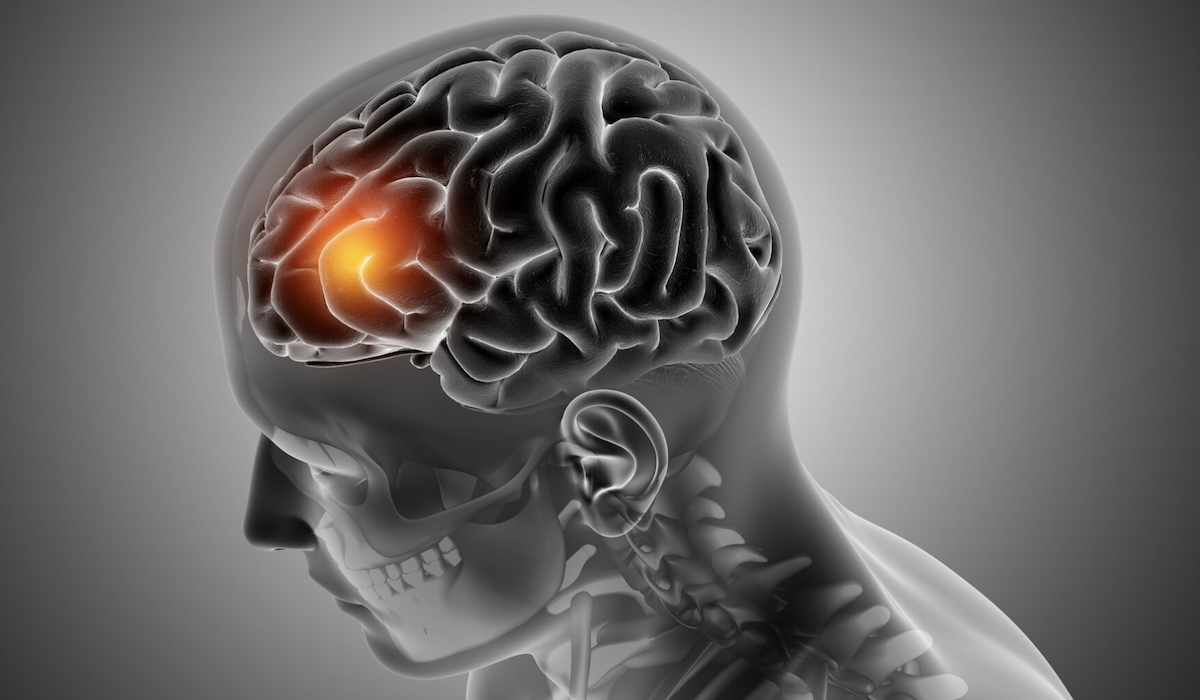 Penyakit radang otak