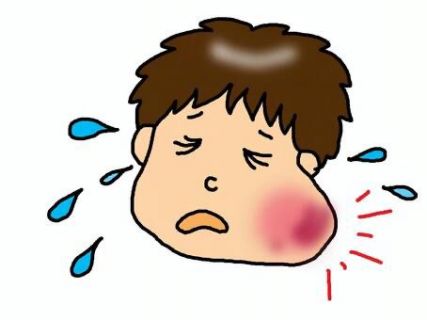 Ilustrasi penyakit gondongan