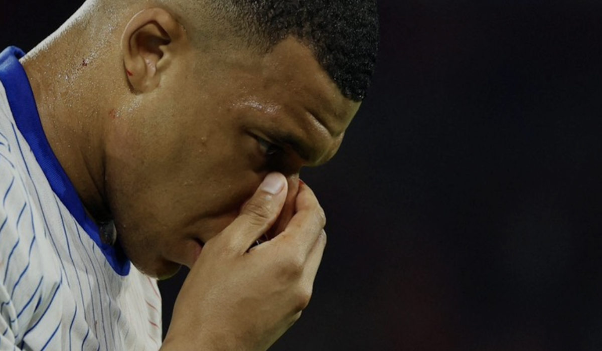 Mbappe latihan dengan perban di hidung