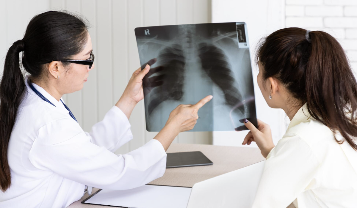 Ilustrasi penyakit Tuberkulosis