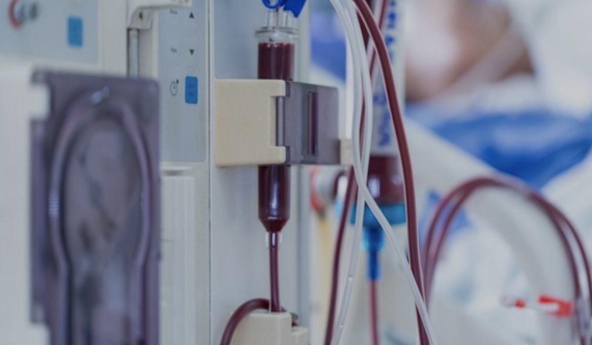 Penyebaba angka pasien cuci darah anak di RSCM meningkat