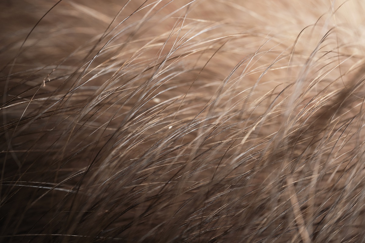 Ilustrasi - Rambutmu ada kutu? Hal berikut merupakan penyebab dari kutu dan cara mengatasinya.