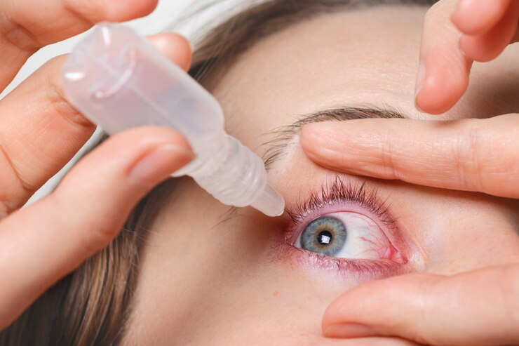 Tips Memilih Softlens Yang Aman untuk Mata, Ini Rekomendasi Dokter