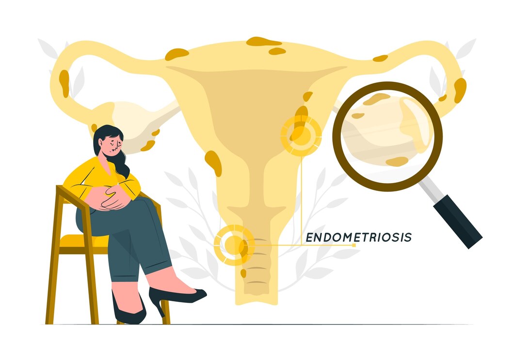 Tiga Cara Pemeriksaan Tuba Falopi, Kerusakan Terbanyak Disebabkan Infeksi dan Endometriosis