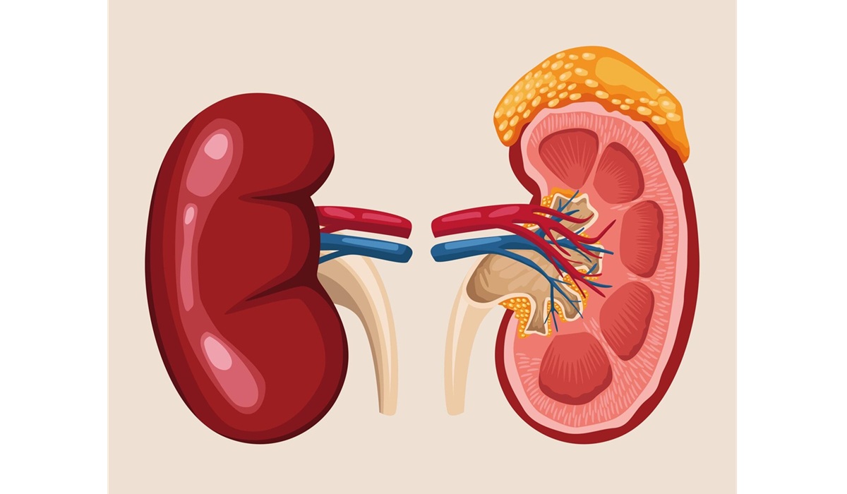 Pasien Hipertensi, Diabetes, dan Obesitas Rentan Alami Gagal Ginjal