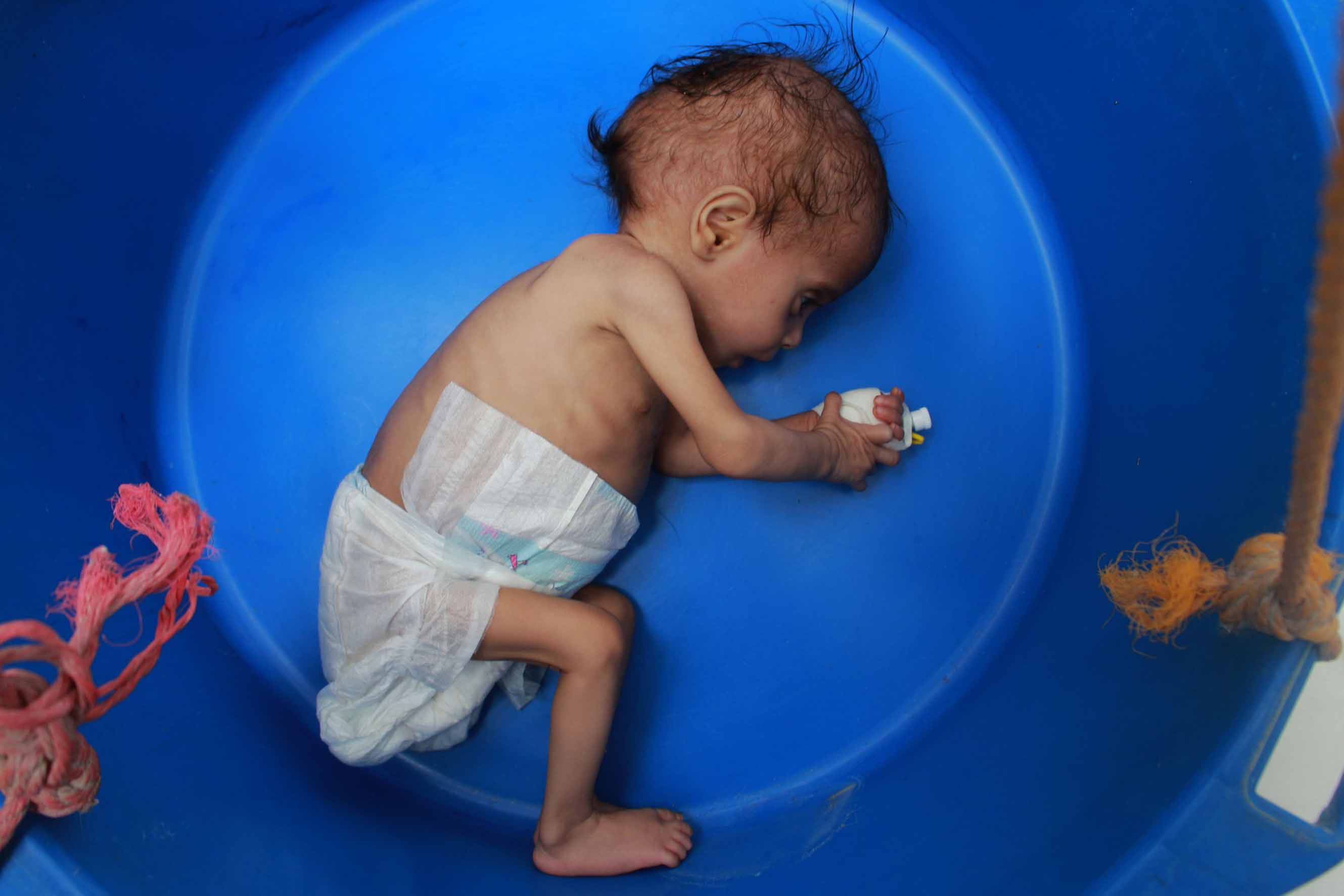 Konflik Panjang Menghancurkan Sistem Kesehatan di Yaman