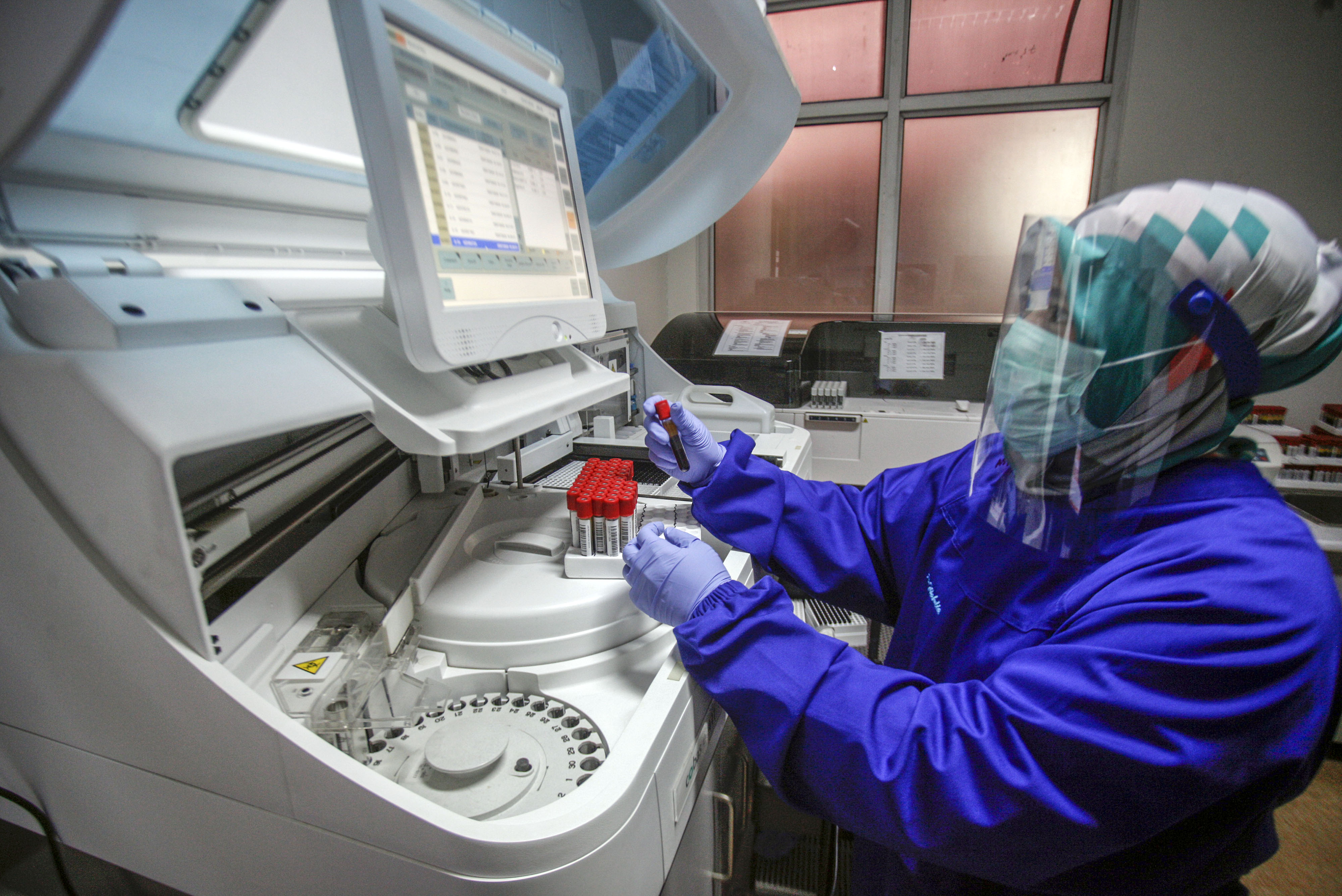 Stok Darah PMI di Bogor Menurun