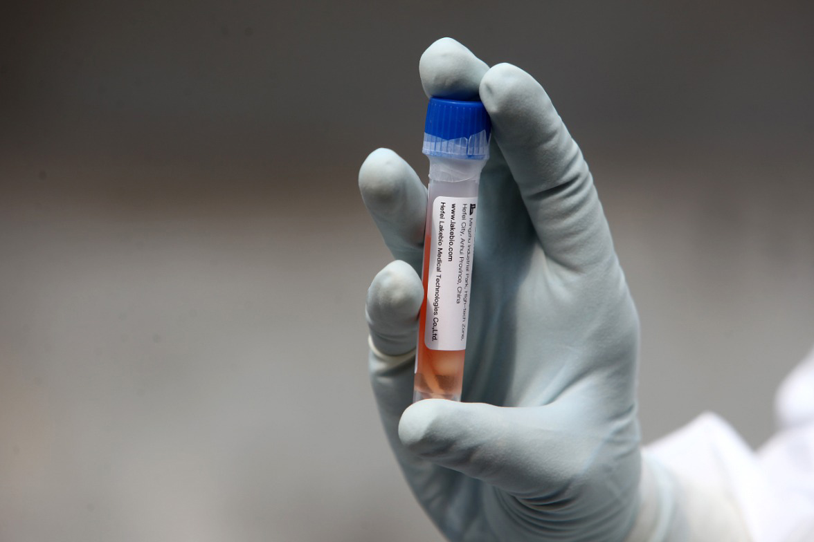 Tes Swab di Pasar Tasik Tanah Abang