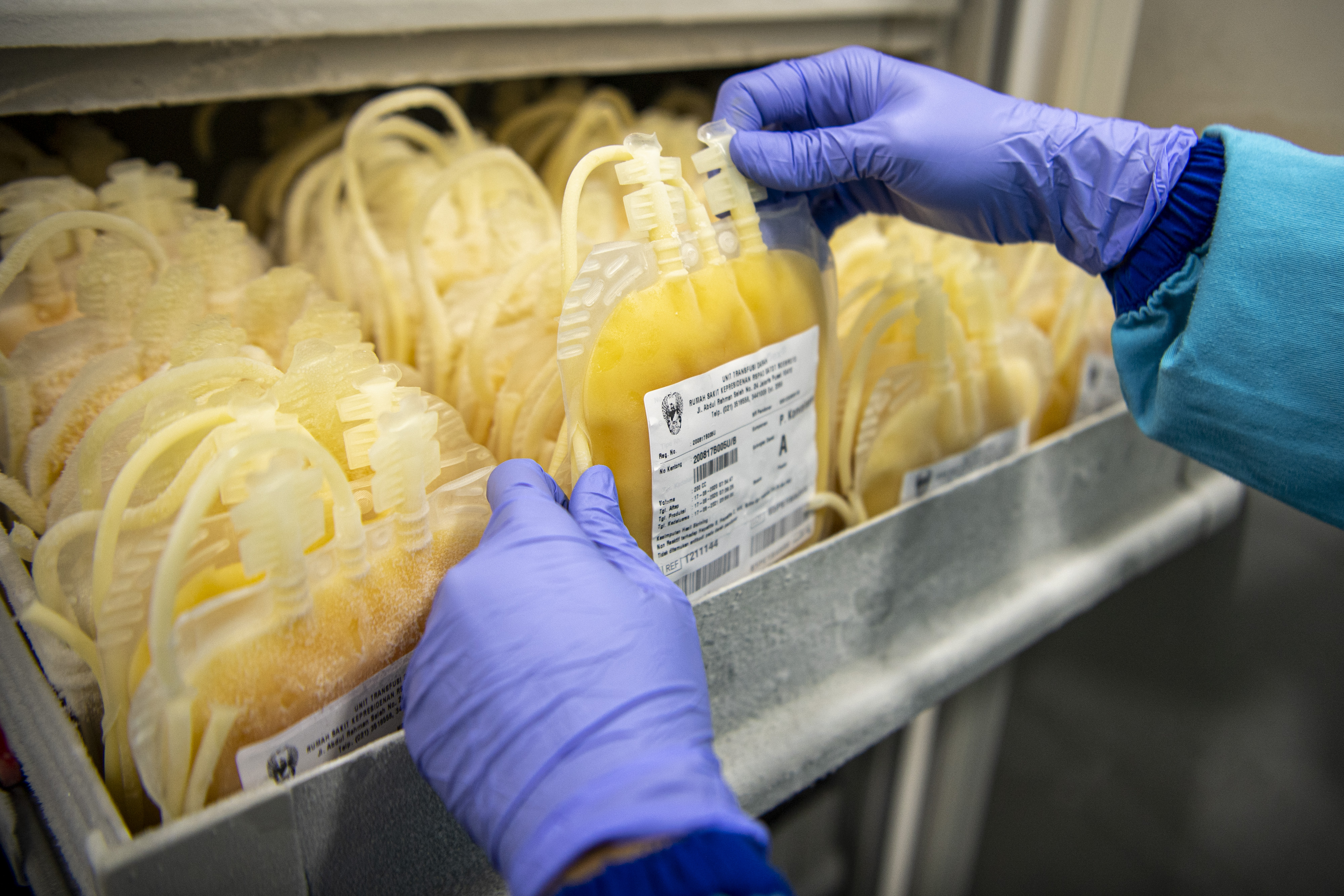 Donor Plasma Konvalesen Pasien Sembuh Covid-19