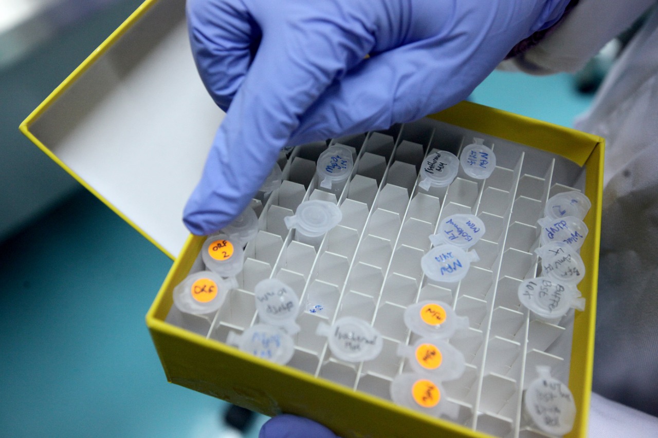 Pengembangan Deteksi Pasien Covid-19 oleh LIPI