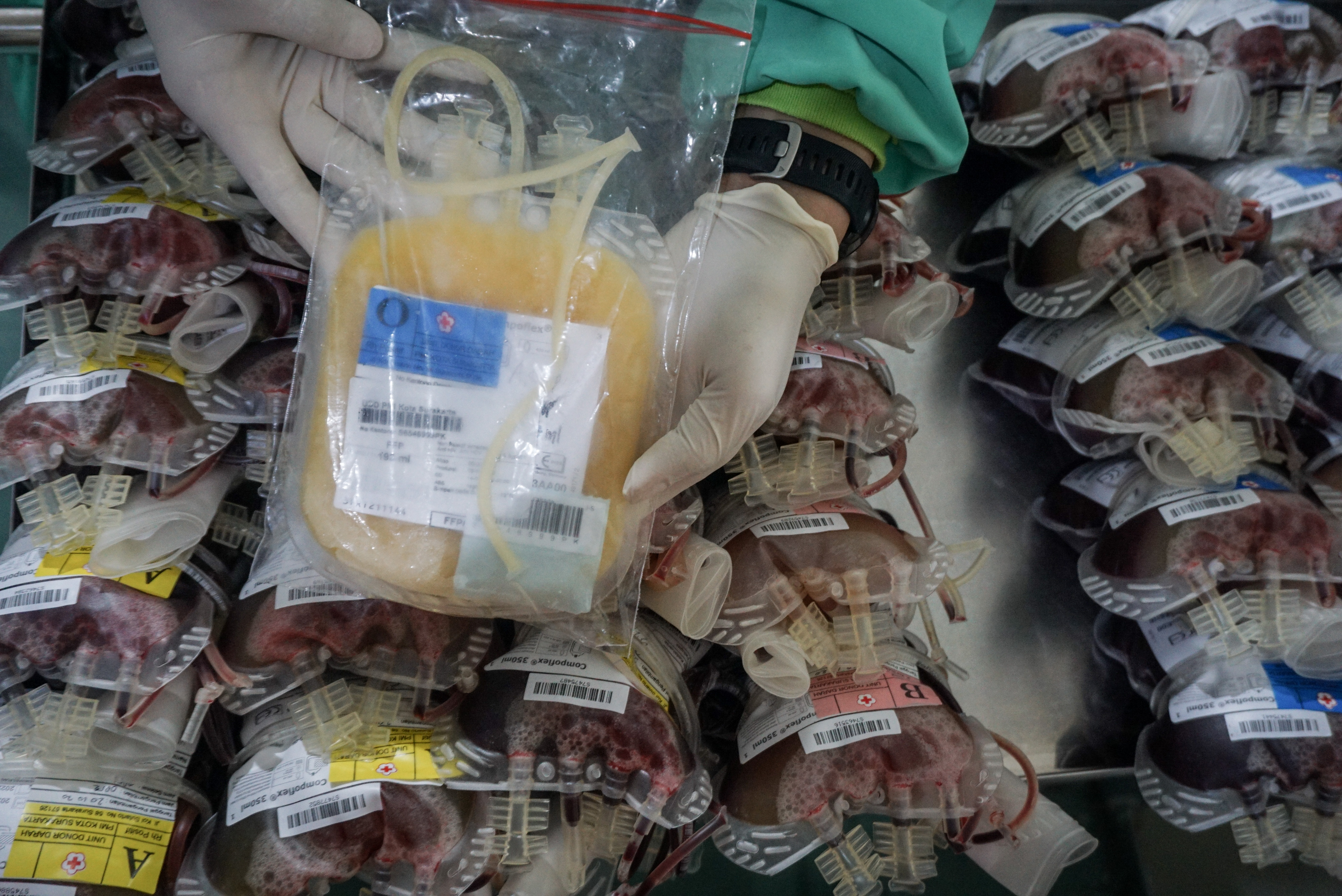 Donor Plasma Darah Konvalesen Pasien Sembuh Covid-19