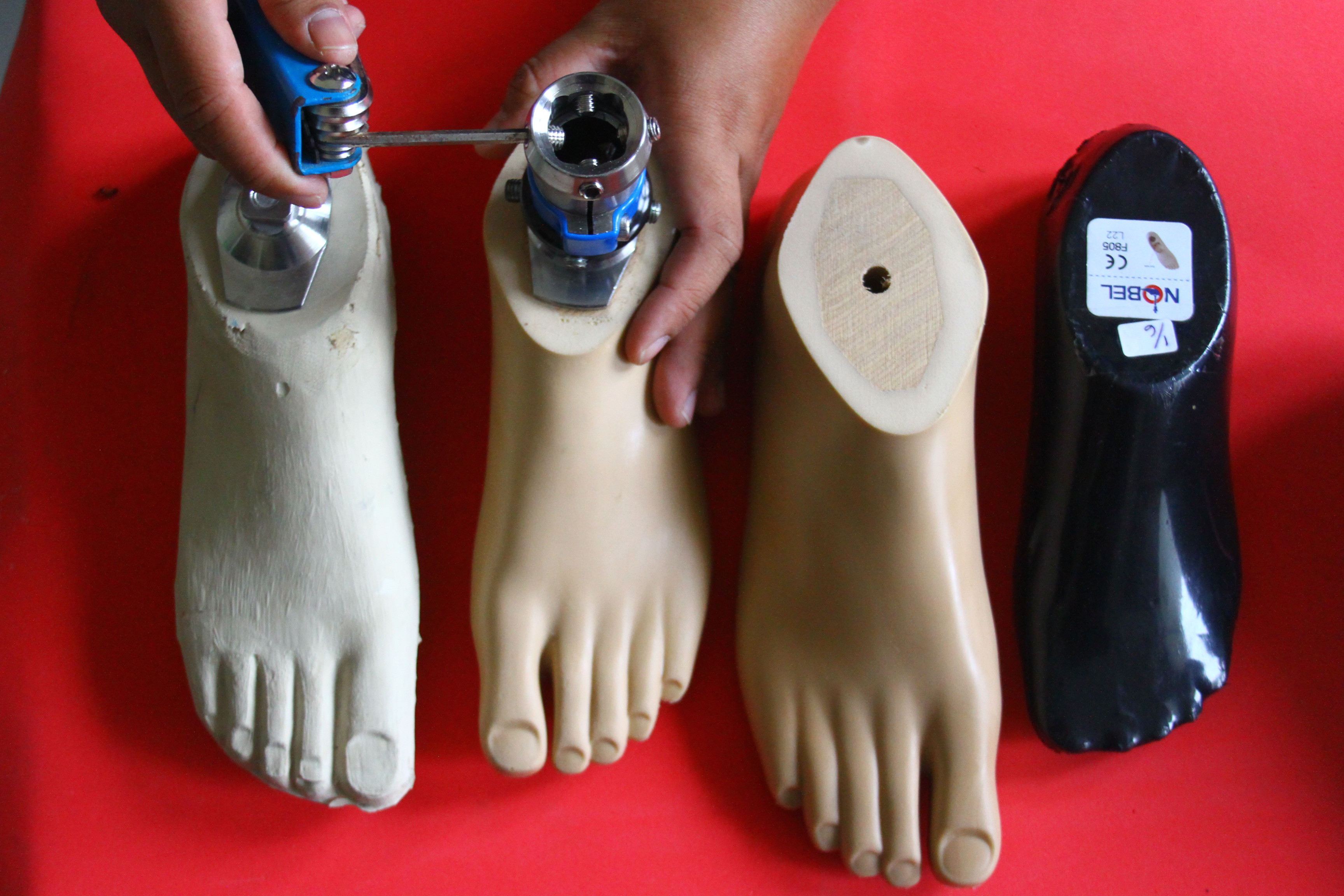 Kekurangan Perajin Kaki Palsu