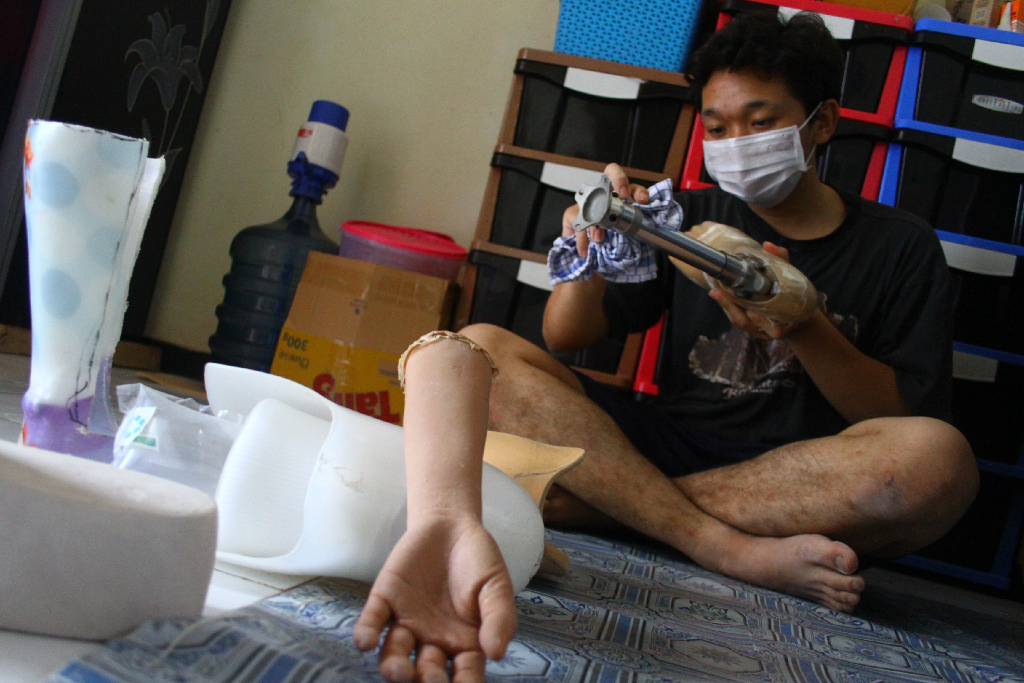 Kekurangan Perajin Kaki Palsu