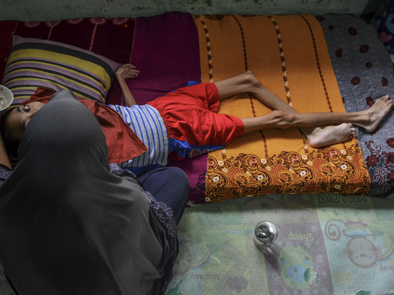 Penderita Gizi Buruk Di Pangandaran