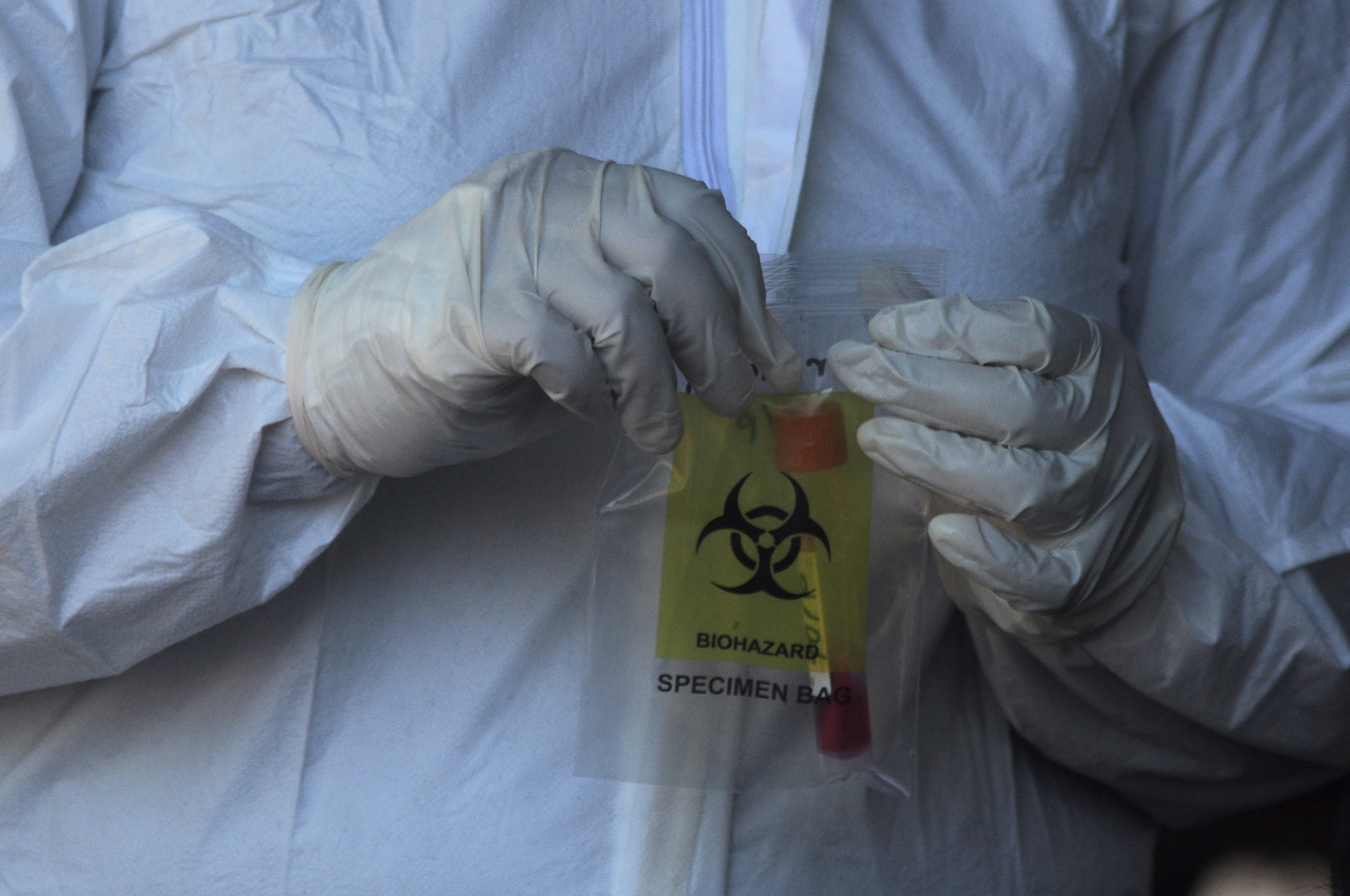 Tracing Covid-19 di Manado