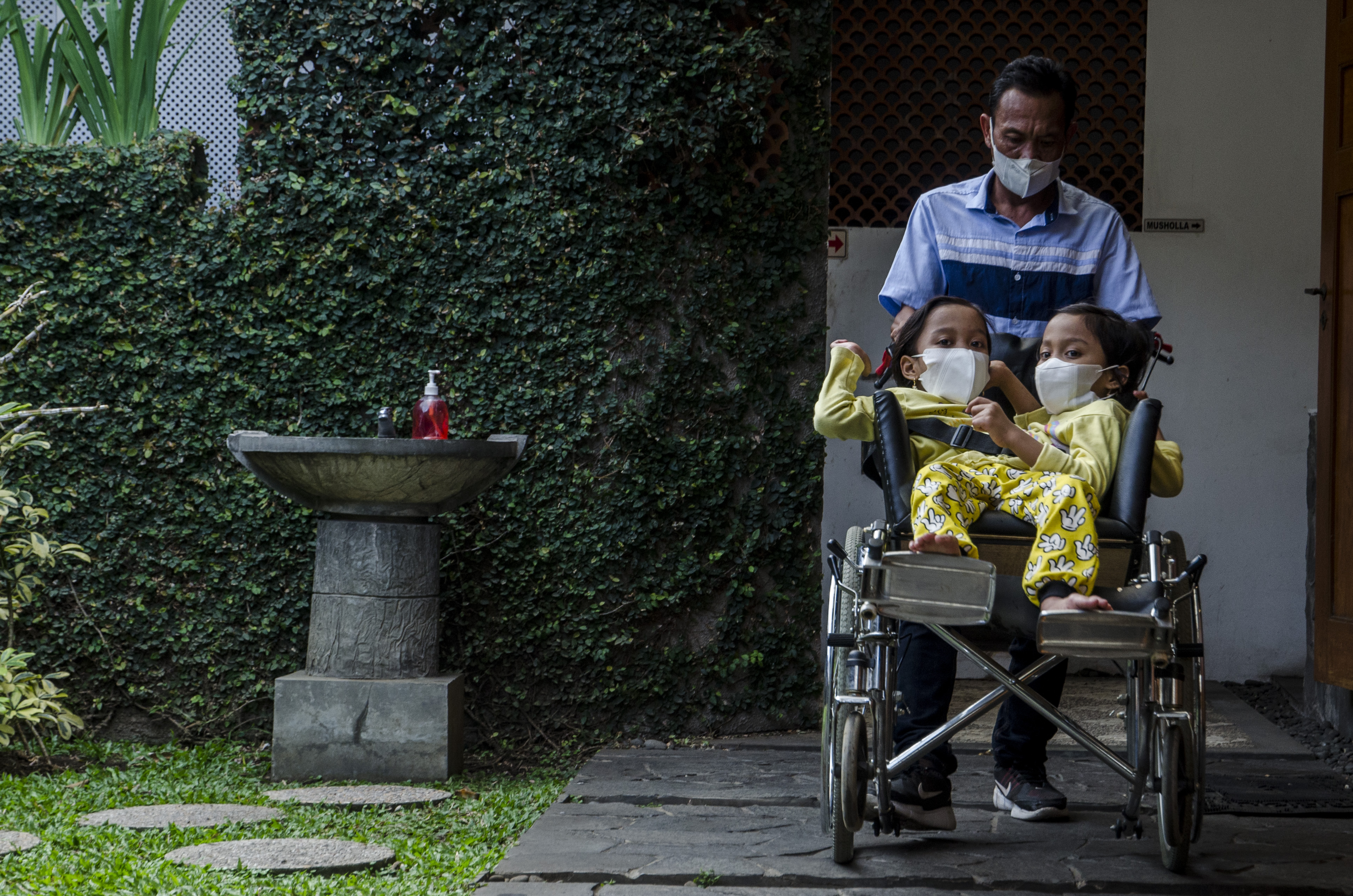 Kembar Siam Asal Garut