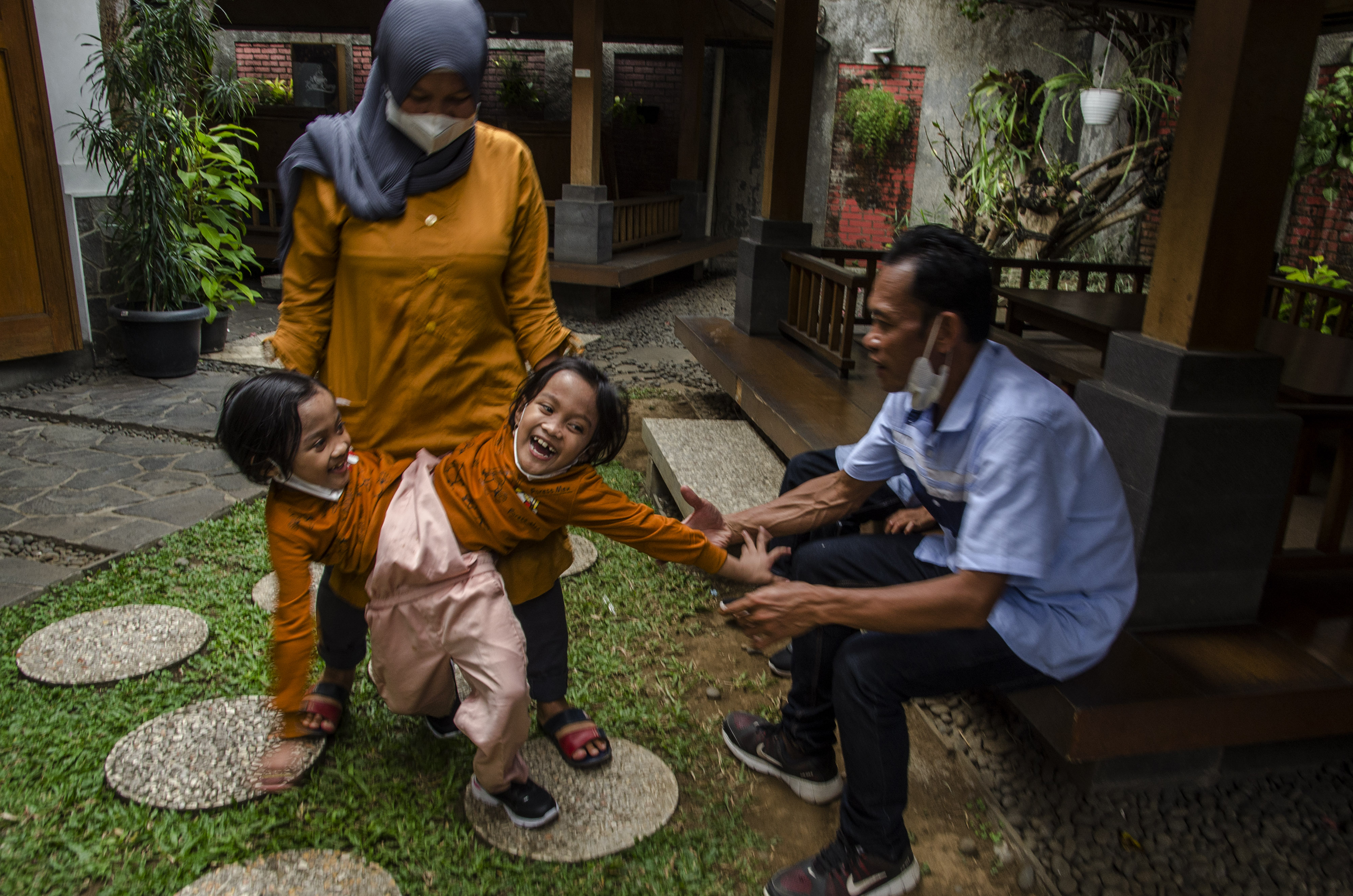 Kembar Siam Asal Garut