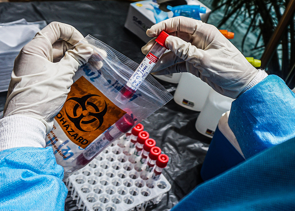 Tes PCR Covid-19 Bagi Tamu Undangan Pembukaan Peparnas