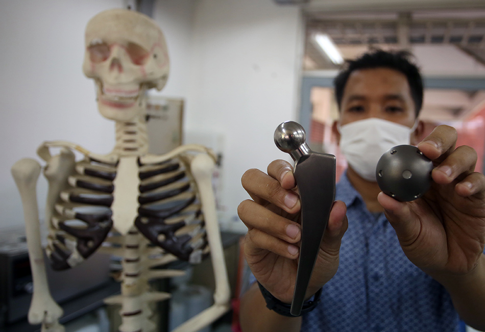 Implan Tulang Pengganti Sendi Panggul 