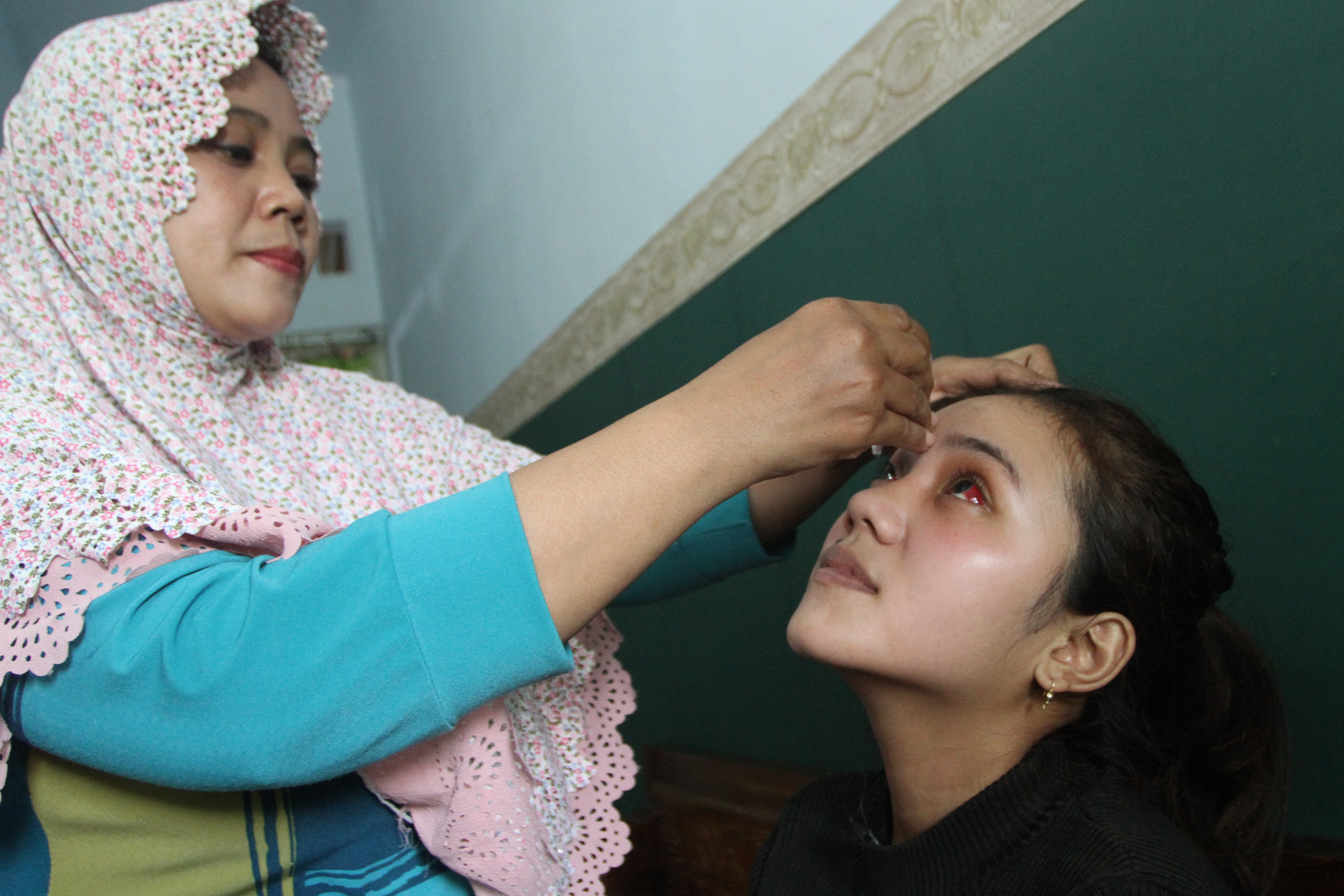  Korban Luka  Tragedi Kanjuruhan