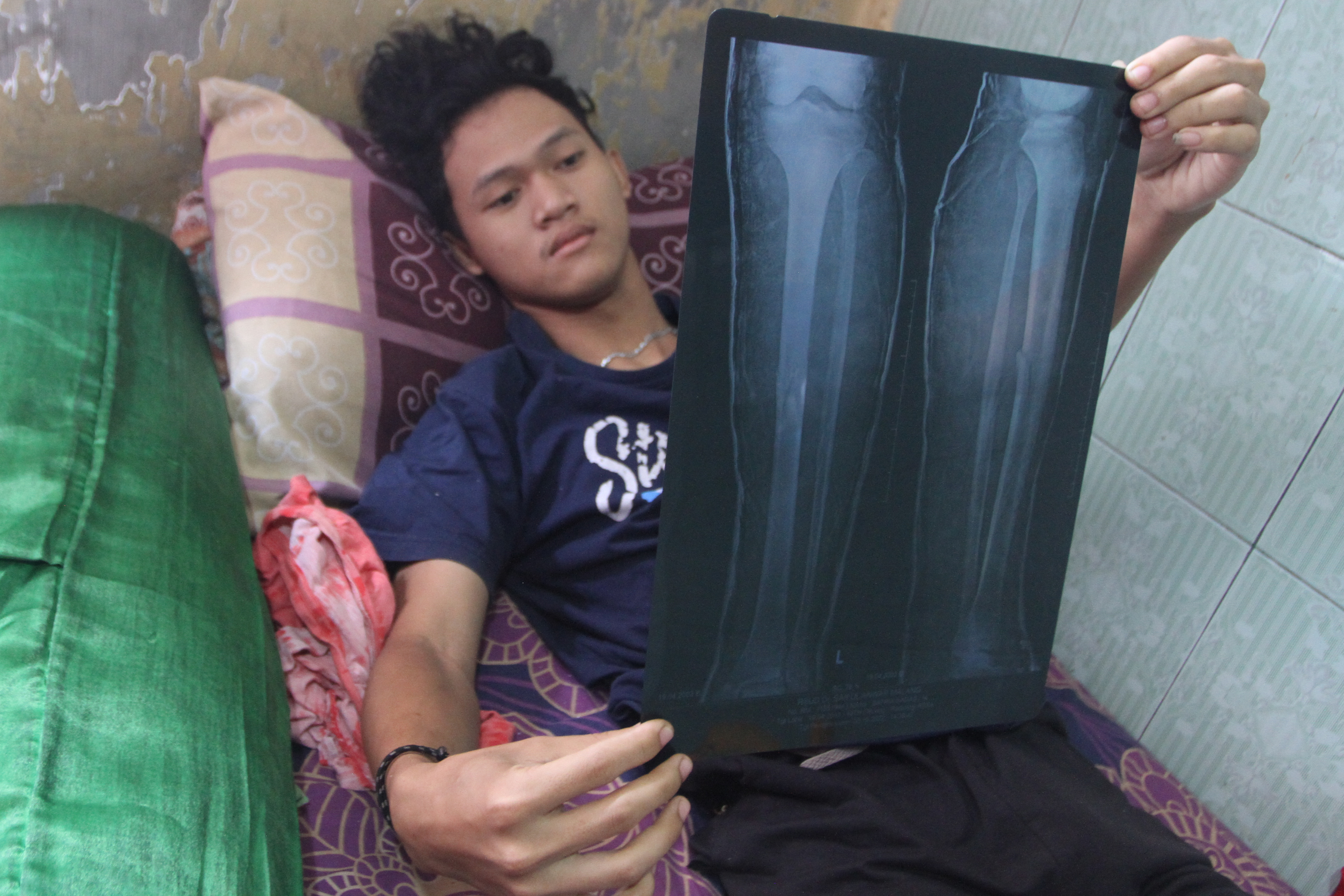  Korban Luka  Tragedi Kanjuruhan