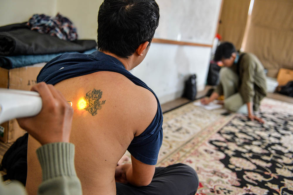 Hapus Tato Gratis di Bandung